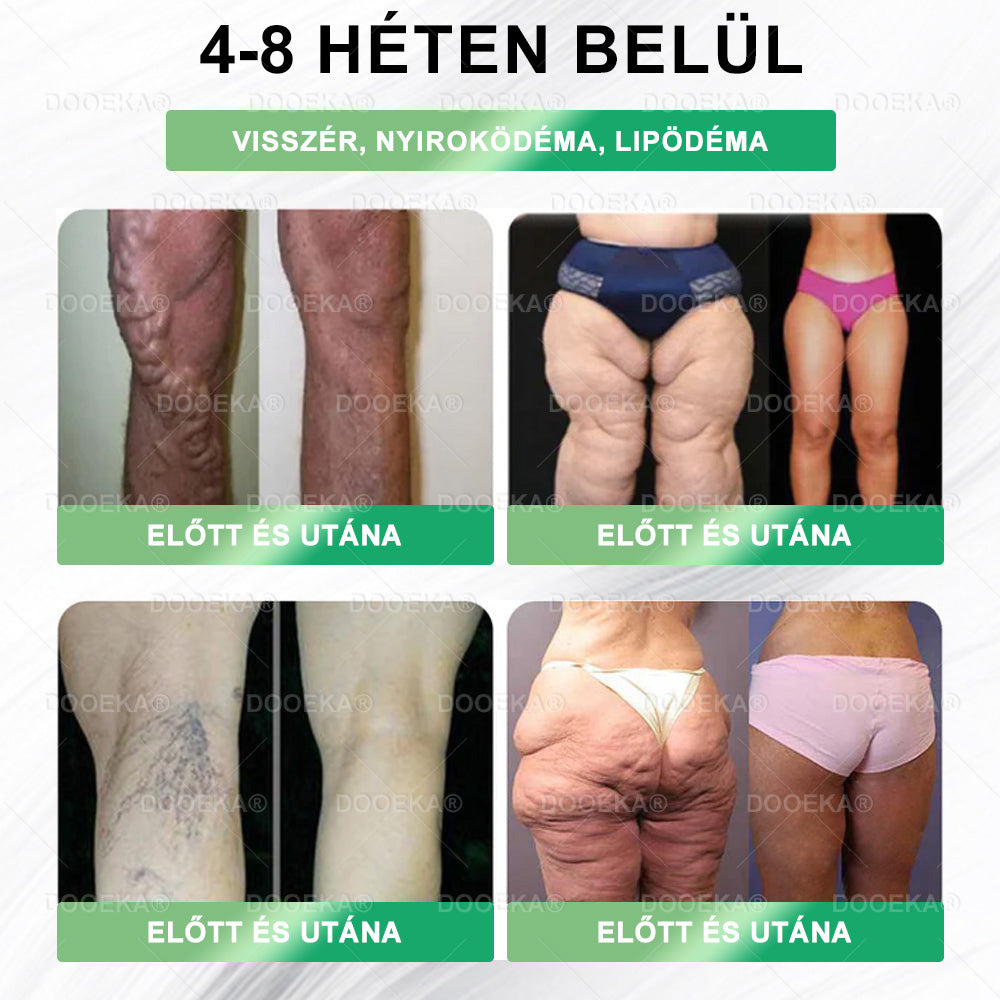 🏥DOOEKA® GLP-1 8 az 1-ben Fit & Vital Szájon át szedhető oldat – Napi egyszer, 7 nap alatt látható változás / Elhízás, szív- és érrendszeri egészség, cukorbetegség, alvási apnoe, bélrendszer egészsége, ízületi problémák és még sok más esetén